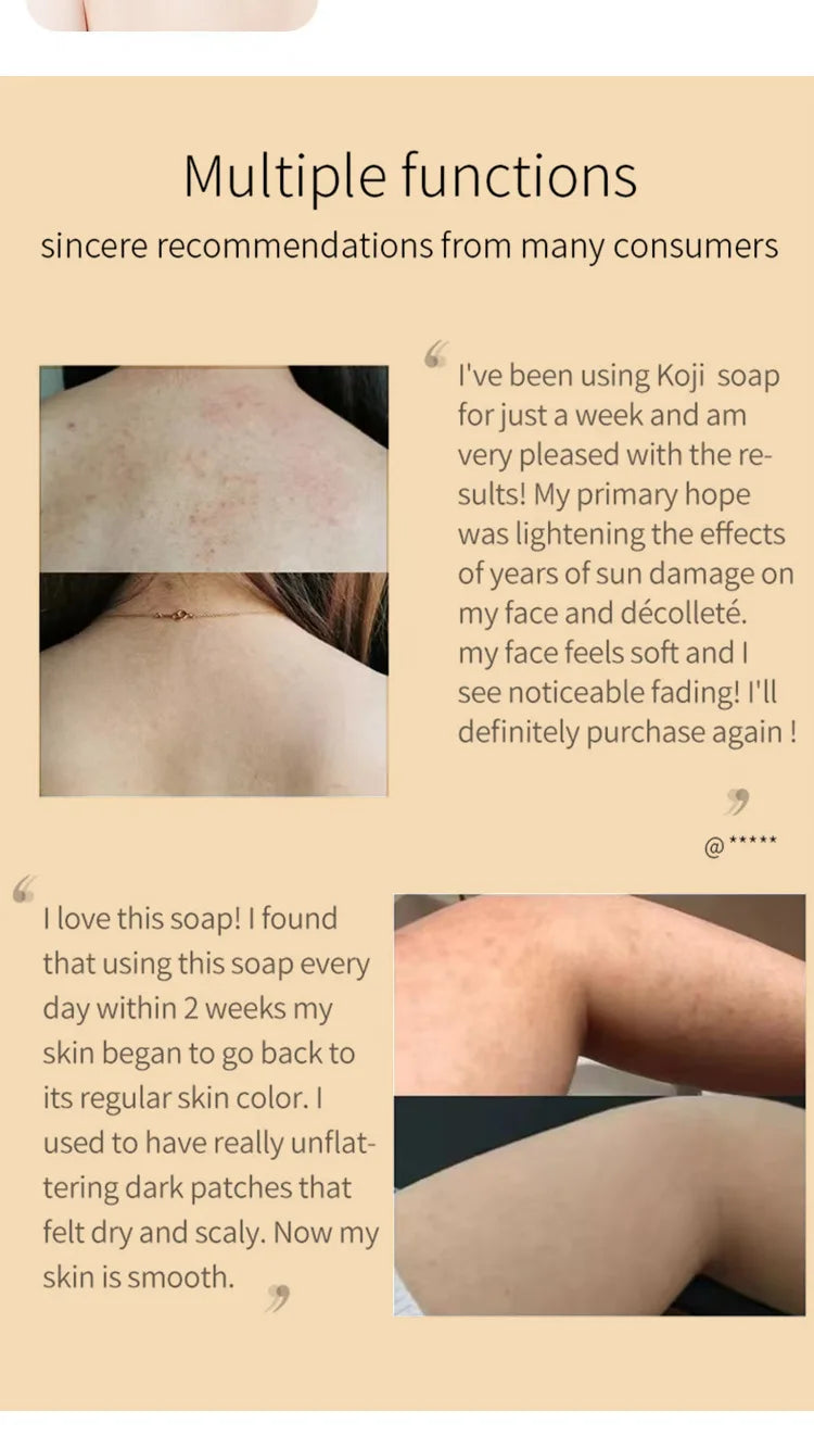 Kojic Acid Whitening Soap – Handmade Brightening Cleanser