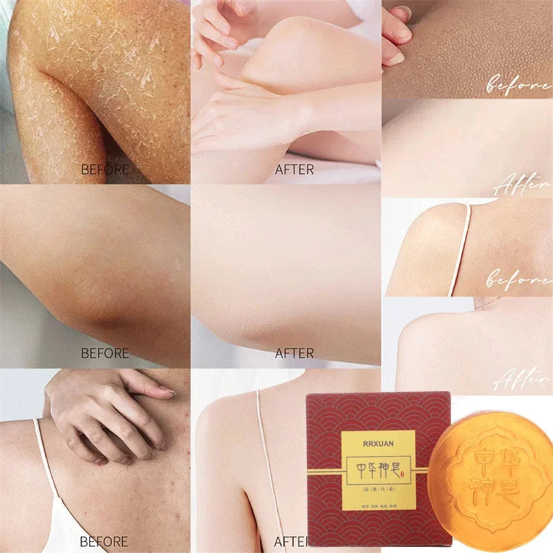 Body Whitening Soap – Deep Clean & Brightening Care