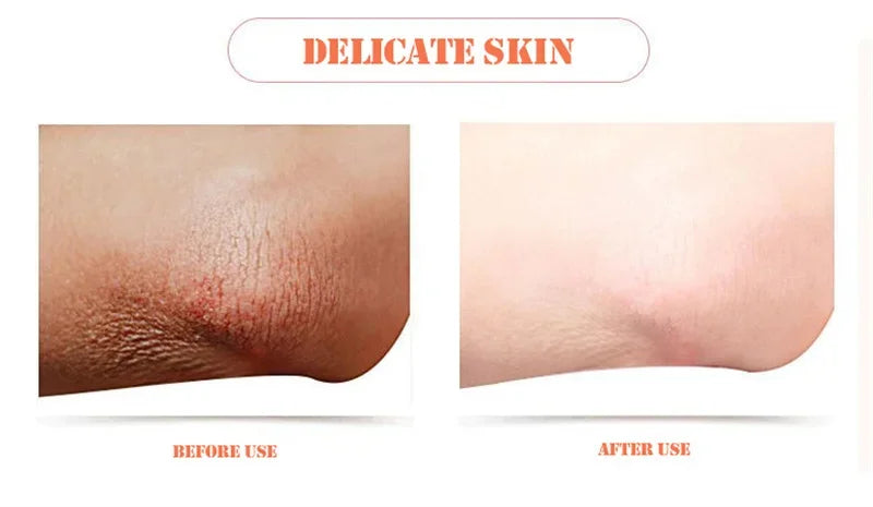 Deep Whitening Body Soap – Brightening & Nourishing Care