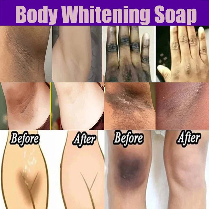 Body Whitening Soap – Deep Clean & Brightening Care