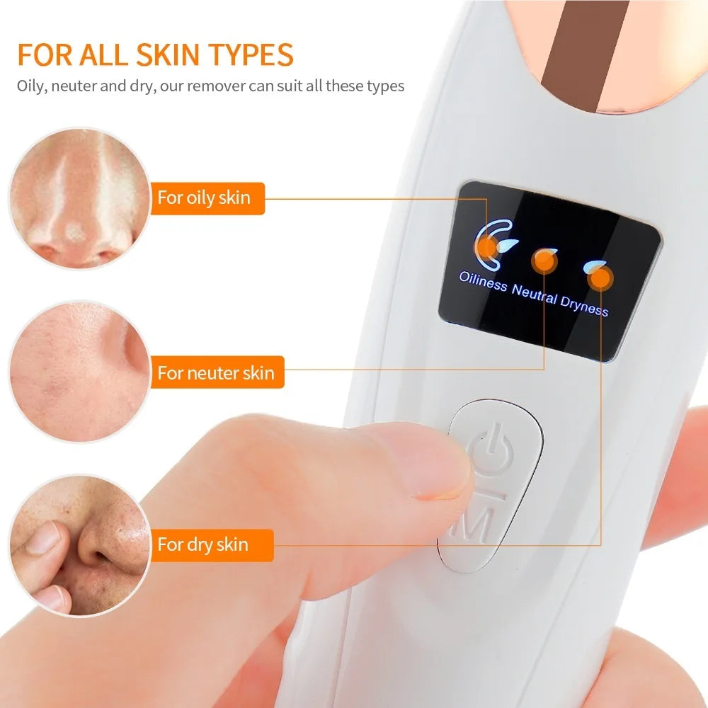 Facial Blackhead Vacuum Remover