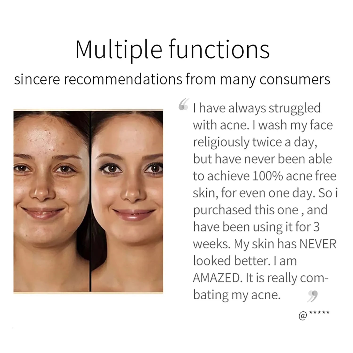 100g Turmeric Whitening Soap Bar