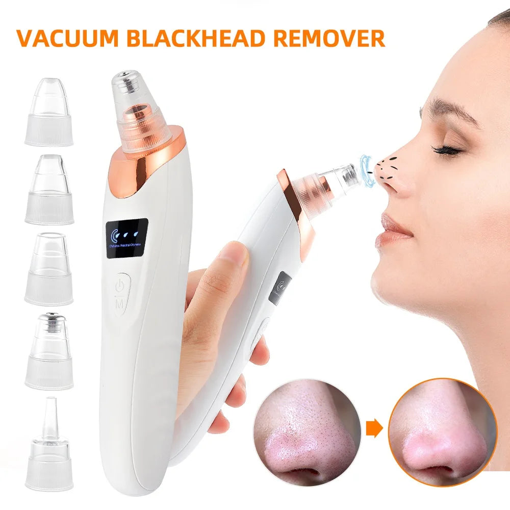 Facial Blackhead Vacuum Remover