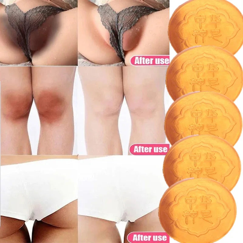 Body Whitening Soap – Deep Clean & Brightening Care