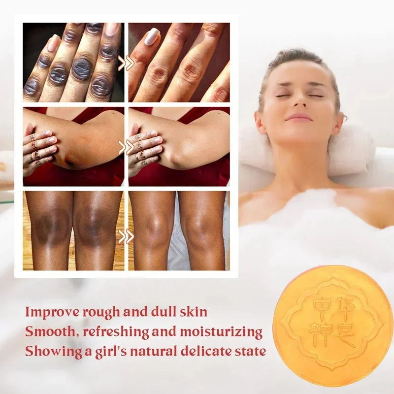 Body Whitening Soap – Deep Clean & Brightening Care