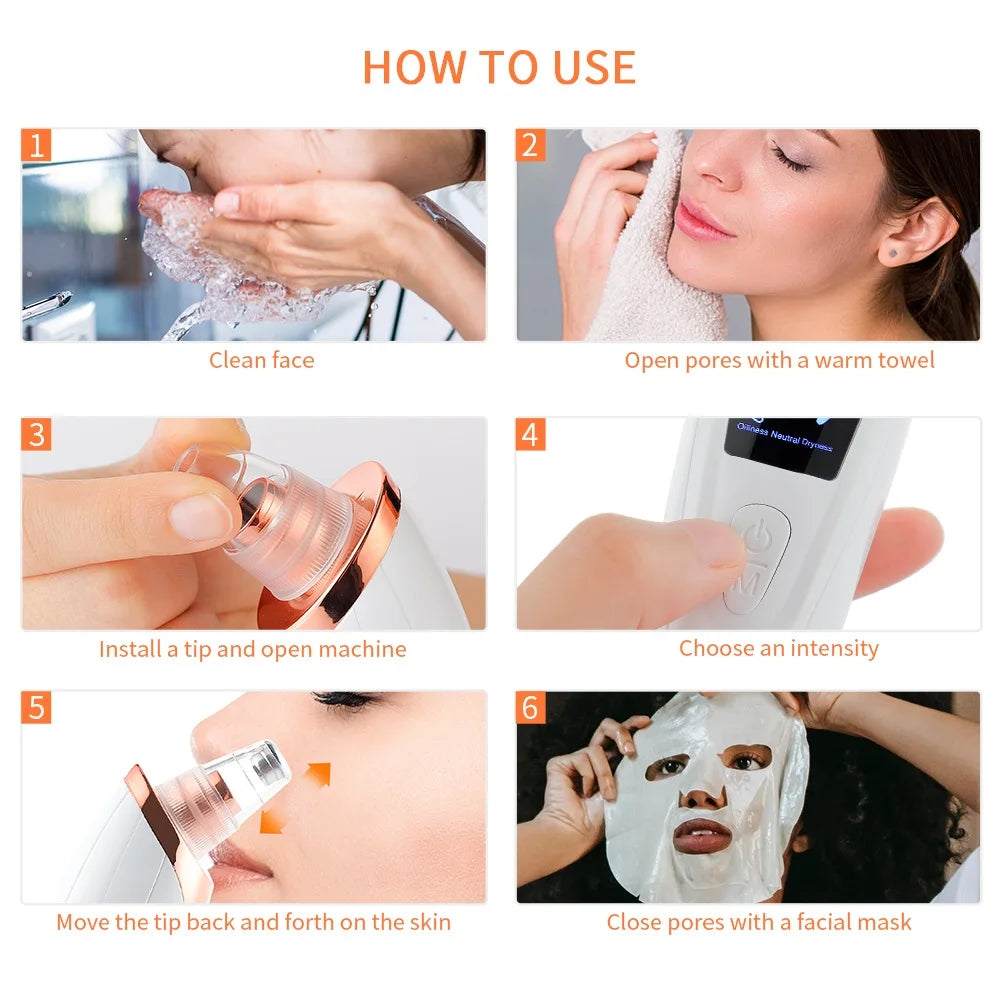 Facial Blackhead Vacuum Remover